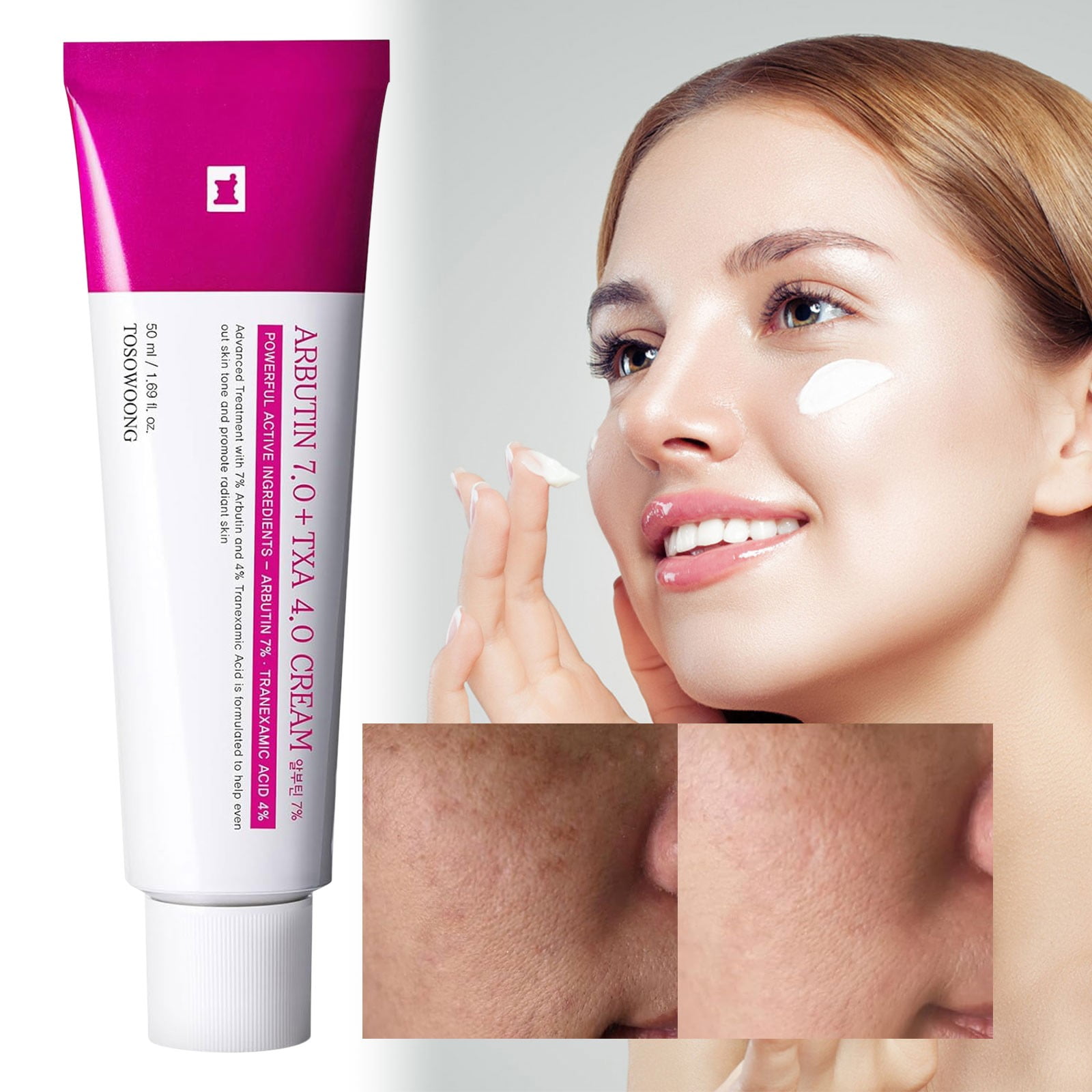 Tosowoong Arbutin 7% + Tranexamic Acid 4% Cream, 70,000ppm