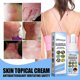 thumbnail image 4 of 2Pcs Ringworm Cream - Treats Stubborn Ringworm Infections, Fights Ringworm On Skin, Anti-Fungal Tolnaftate, Powerful Treatment,30ml, 4 of 5