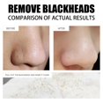 thumbnail image 4 of 60 Tiras Removedoras de Y Puntos Nasal para La Nariz Ingredientes Premium Baoblaze removedor de espinillas, 4 of 8