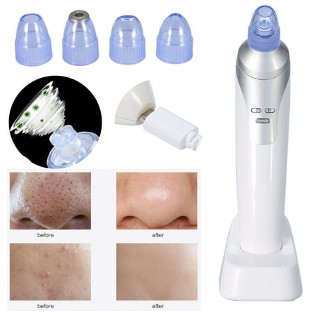 WALFRONT Microdermabrasion Machine,Portable Facial Pore Cleaner Nose Blackhead Removal Vacuum Comedo Suction Tool Beauty Device,Pore