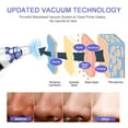 thumbnail image 6 of Blackhead Remover Vacuum - Electric Blackhead Removal Tool Acne Comedo Pore Cleaner, 5 Adjustable Suction Power and 5 Replaceable Suction Probes, LED Screen (White), 6 of 6