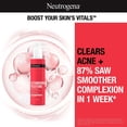 thumbnail image 2 of Limpiador facial Neutrogena Stubborn Texture con ácido salicílico 180 ml, 2 of 5