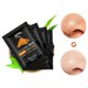 thumbnail image 3 of kit 5 Mascarillas facial Para retirar Puntos Negros VULCAN mascarilla, puntos negros, cuidado, 3 of 5