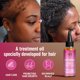 thumbnail image 4 of Suero de aceite de batana africana para la reparación rápida de la calvicie hereditaria, la pérdida de cabello seborreica posparto y el tratamiento para el recrecimiento del cabello en hombres y mujer, 4 of 5