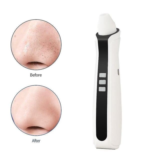 Limpiador facial removedor de puntos negros HUOGUO Recargable USB