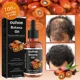 thumbnail image 2 of Aceite Esencial de queratina para cabello seco y dañado, mascarilla para el cabello, aceite complejo de plantas secas, productos para el cuidado, 100% puro, Batana, 2 of 5