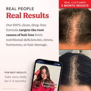 HAIRtamin Advanced Formula Supplement for Hair Health – With Biotin, Vitamins & Antioxidants – 100% Vegan, 1-Month Supply – For Women & Men
