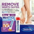 thumbnail image 3 of Maximum Strength Salicylic Acid Solid-Stick Common and Plantar Wart Remover 0.2 Oz, 3 of 7