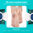 thumbnail image 4 of pHeet® Foot Wipes - Stops Burning & Itching, All-Natural, Cleanses, Moisturizes, Improves Dry, Cracked & Flaky Skin 72ct, 4 of 12