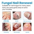 thumbnail image 4 of Anti-Fungal Disinfectant Spray for Nail Fungus Removal, Fast-Acting Solution, Eliminates Odor, 100ml Bottle, Safe for Daily Use, 4 of 8