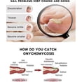 thumbnail image 3 of 26-27 Nail Care Nail Repair Cream Nail Fungus Treatment Onychomycosis Nail Carenail Repair Cream Nail Moisturizing Restore Beautiful Nails Fungi Nail, 3 of 5