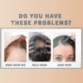 thumbnail image 2 of Hair Serum Hair Growth Dense Regrowth Ginger Serum Oil Ant Loss Esse, 2 of 5