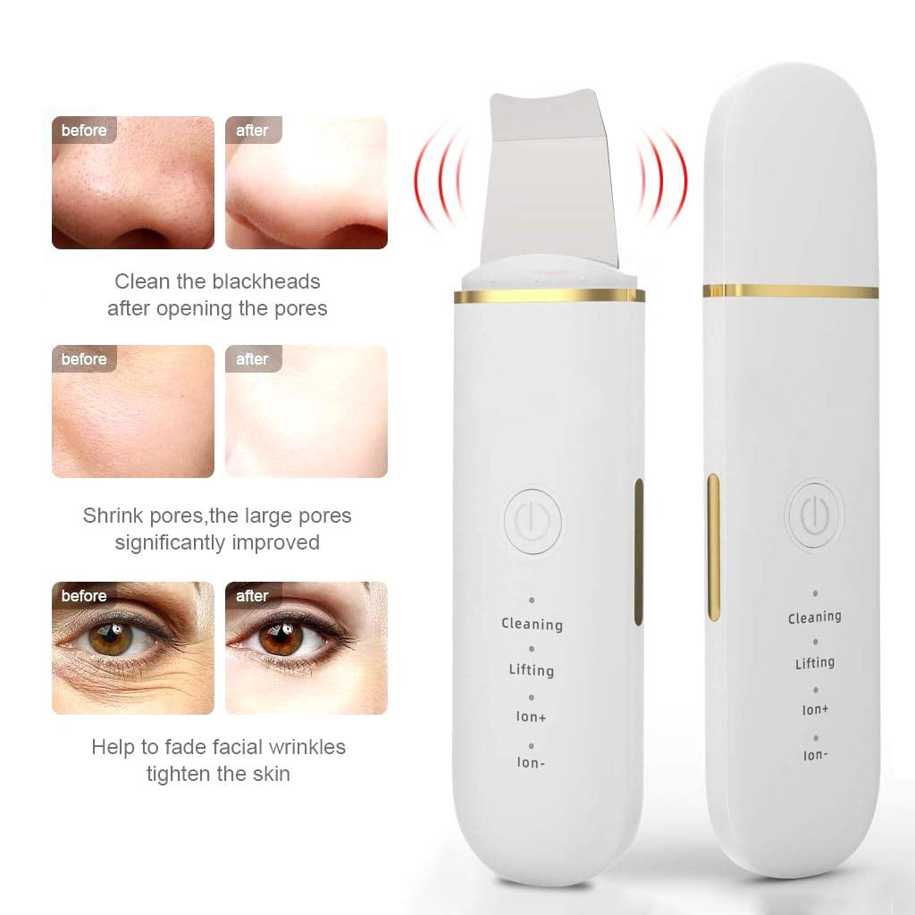 New Ultrasonic Skin Cleaner Removes Deep Oil Dirt and Blackheads Facial Cleansing and Enhances Exfoliating Vibrating Shovel Pore Cleaner