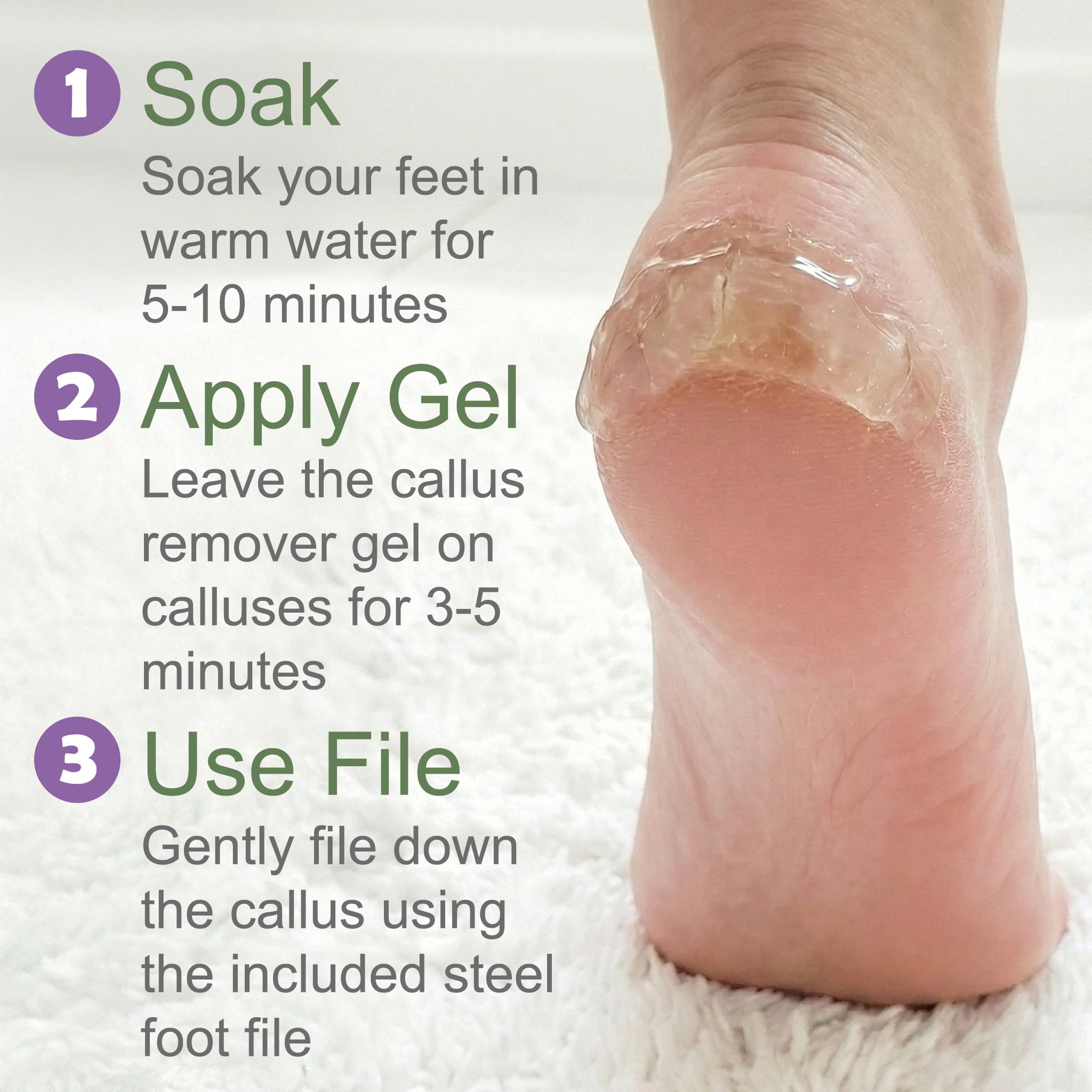 Dr. Entre's Callus Remover Gel & Foot File: Extra Strength Callus Remover for Feet, Foot Callus Remover, Pedicure Tools Supplies, Spa Kit, Dead Skin Scrubber, Corn & Callus Trimmers, 4 oz EntreFeet