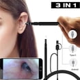 thumbnail image 2 of Ear Cleaning USB Endoscope Camera Tool with 6 Adjustable LED Lights for Phone/Micro USB/Type-C/USB PC, 2 of 4