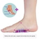 thumbnail image 1 of Foot Support Pads Healthy Supplies Silicone Arch Support Insoles Arch Pad For Flat Foot, Plantar Fasciitis, High Arches, Orthotic ANGGREK No, 1 of 7