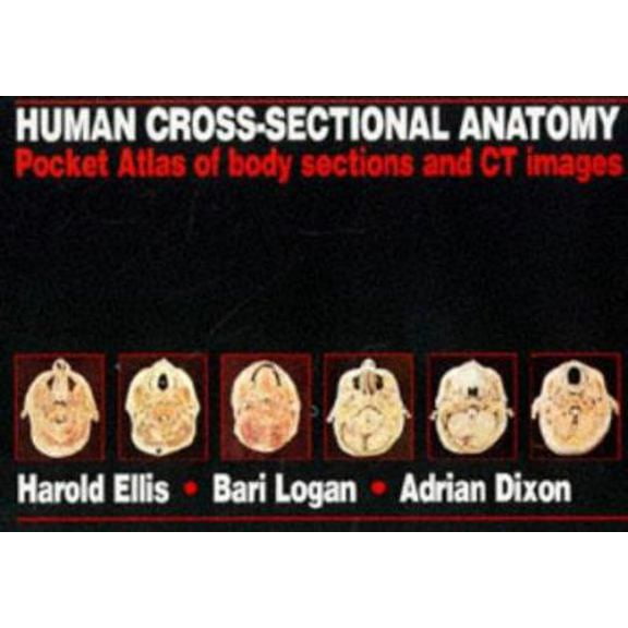 Pre-Owned Human Cross-Sectional Anatomy: Pocket Atlas of Body Sections and CT Images (Paperback) 0750620285 9780750620284