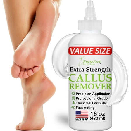 Dr. Entre's 16oz Callus Remover Gel: Extra Strength Value Size, Callus Remover for Feet, Pedicure Tools Supplies, Dead Skin Remover, Foot Care EntreFeet