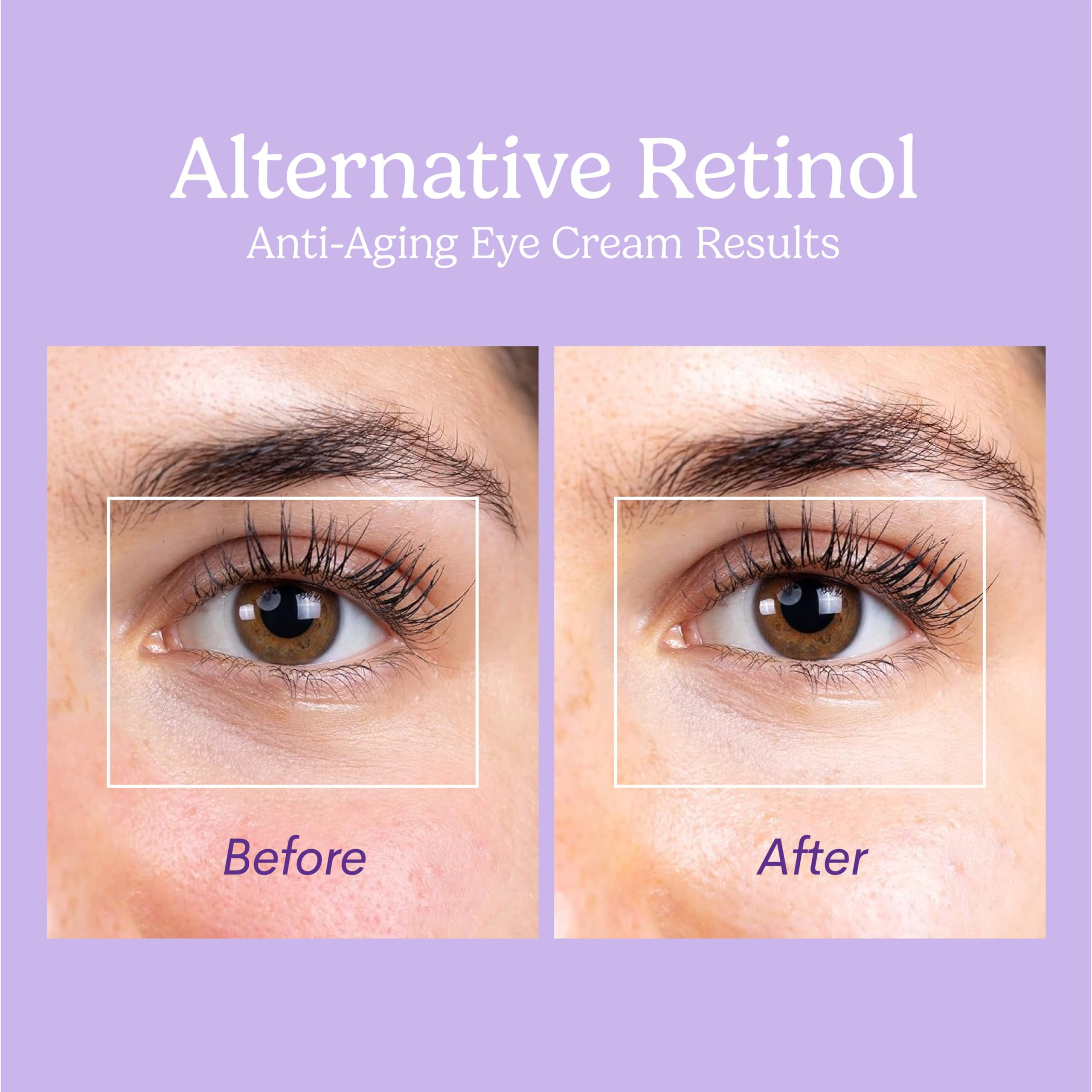 Excuse My Frank Bakuchiol Age Defense Eye Cream Correction for Puffy Eye Bags Fine Lines Dark Circles Wrinkles, Korean Skin Care