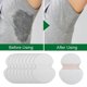 thumbnail image 3 of CHAO Paquete de 40 almohadillas para las axilas Almohadillas para el sudor de las axilas para hombres y mujeres Almohadillas para las axilas cómodas e invisibles, 3 of 5