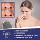 thumbnail image 3 of Jaysuing Deep Pore Cleansing Paste Deep Cleansing Nose Blackhead Closed Mouth Firming Pore Care Nasal Sticker - 6Pcs, 3 of 4