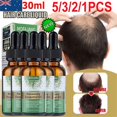 thumbnail image 4 of Rosemary Hair Growth Serum Essential Oil, 4 of 5