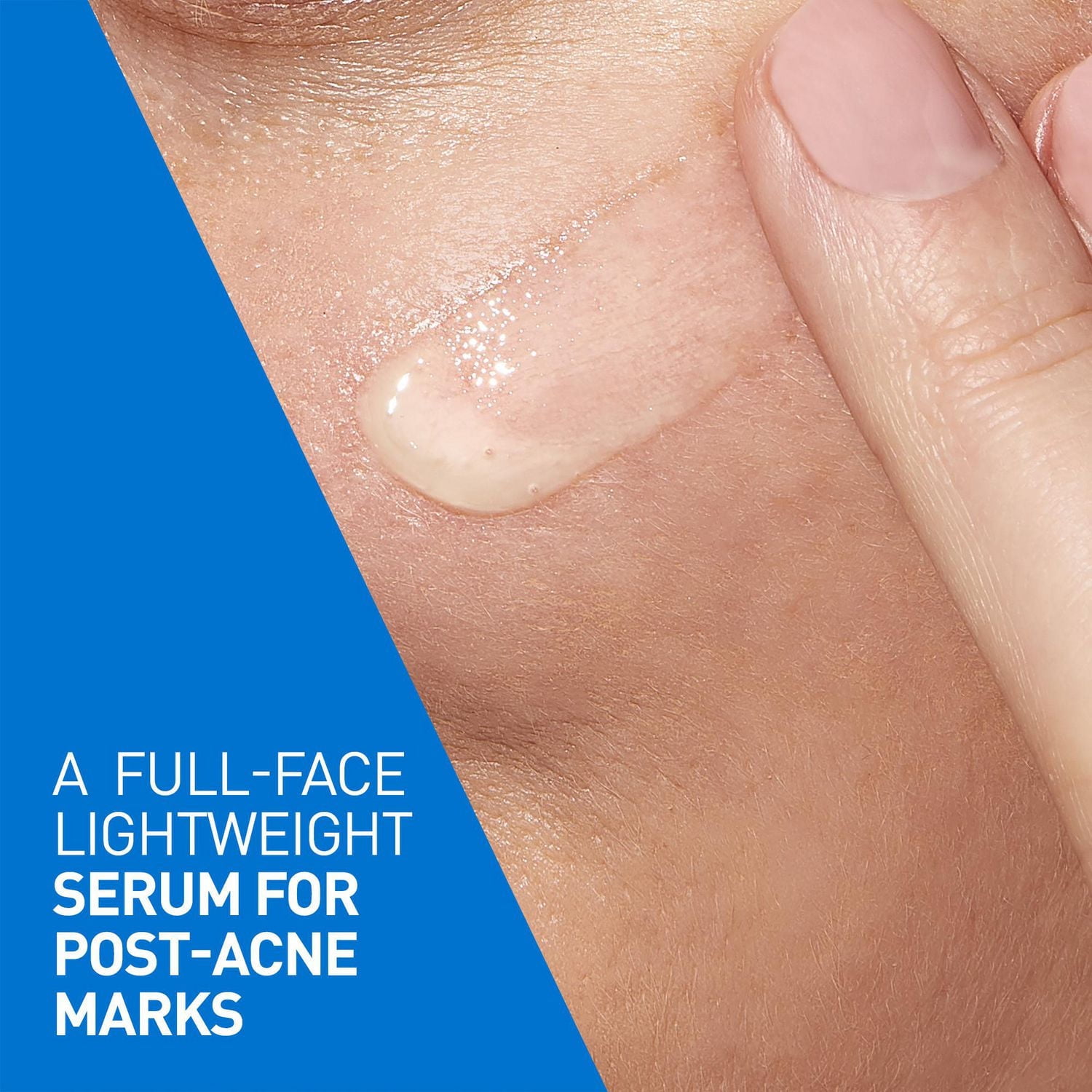 CeraVe Resurfacing Retinol Serum for Face with Niacinamide & Encapsulated Retinol. Helps even Skin Tone, Improve Skin Smoothness & Reduce Post-Acne Marks. Gentle, Fragrance-free, & Non-Comedogenic, 30, A full-face lightweight serum