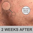 thumbnail image 5 of Beard Growth Kit, Beard Derma Roller 0.3mm, Beard Oil for Facial Hair Growth for Men and Dads, Grooming Tool, 5 of 5