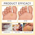 thumbnail image 5 of 20ml Bee Venom Foot Spray, Diabeticss Foot Healing Spray, Anti-Fungal Treatment for Cracked Heels & Odor Relief Foot Care, 5 of 5