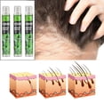 thumbnail image 4 of de esencia para el del cabello, antipérdida de cabello a base de hierbas para prevenir la pérdida de cabello posparto para - 3 piezas Colco Aerosol de hierbas, 4 of 6