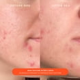 thumbnail image 2 of Crema hidratante Tower 28 Beauty SOS Daily Skin Barrier 50 ml, 2 of 6