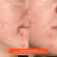 thumbnail image 2 of Crema hidratante Tower 28 Beauty SOS Daily Skin Barrier 50 ml, 2 of 6