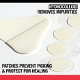 thumbnail image 2 of Parches ultrafinos para acné y granitos Neutrogena, 16 unidades, 2 of 6