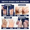 thumbnail image 4 of DPTALR Anti-crack Repair Hand Cream To Improve Chapped Rough Skin, Dead Skin, Moisturize Hands And Feet Cream, 4 of 9