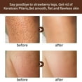 thumbnail image 3 of Mooyam Strawberry Legs Cream For Women, Rough Bumpy Body Cream, Lotion For Dry Skin Strawberry Skin Remover 4.23 fl oz, 3 of 13