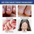 thumbnail image 2 of Bitter Nail Guard Spray, Discourages Thumb Sucking and Nail Chewing, Effective Deterrent with Safe Formula, 2 of 5