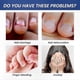 thumbnail image 2 of Bitter Nail Guard Spray, Discourages Thumb Sucking and Nail Chewing, Effective Deterrent with Safe Formula, 2 of 5