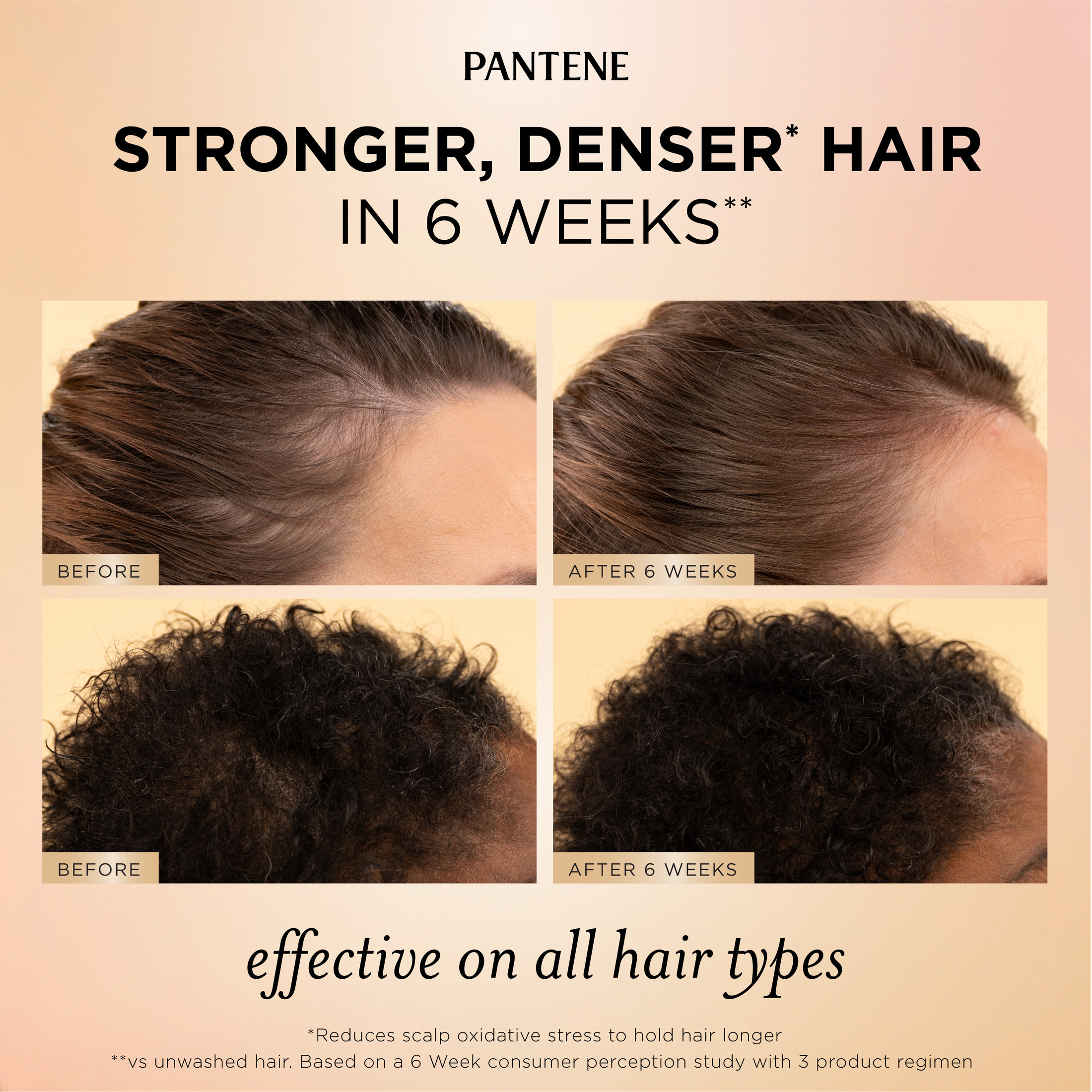 Pantene Abundant & Strong Scalp & Root Hair Serum, 2 oz photo 4