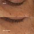 thumbnail image 4 of Sérum concentrado Clinique All About Eyes Brightening, 10 ml, 4 of 8