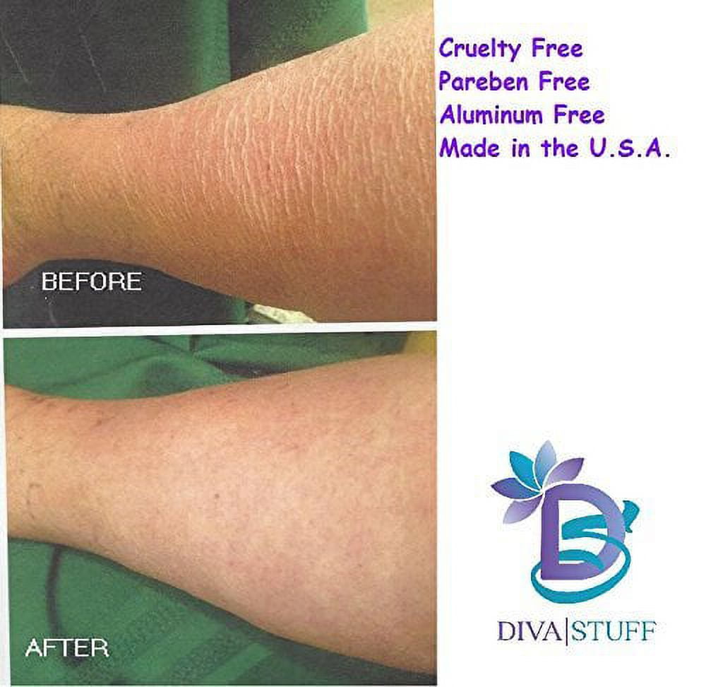 Extreme Crepey Skin Body & Face Cream with Hyaluronic Acid, Alpha Hydroxy and More, by Diva Stuff (Vanilla)