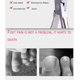 thumbnail image 4 of Pinzas para cutículas Las mejores pinzas de acero inoxidable Tijeras adecuadas para cortar la piel muerta en los bordes de las uñas en manos y pies Herramientas de arte de uñas para hombre JAMW Sencillez, 4 of 5