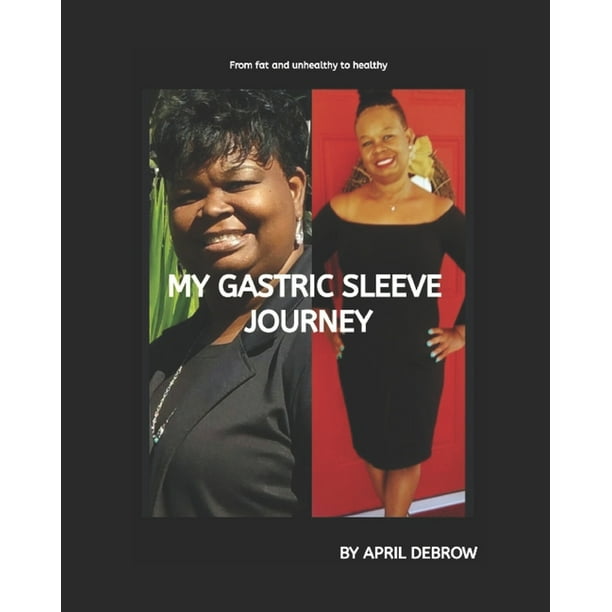 My Gastric Sleeve Journey The ends and Outs About Gastric Sleeve