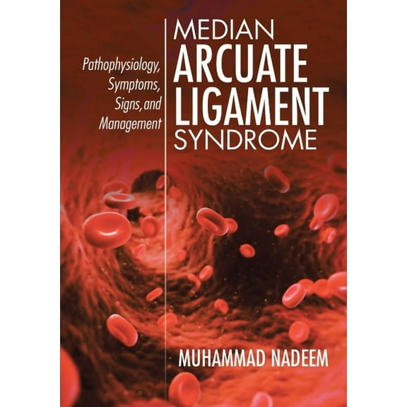 Median Arcuate Ligament Syndrome: Pathophysiology, Symptoms, Signs, and Management, (Paperback)