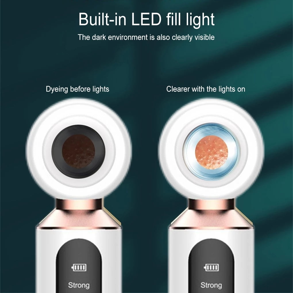 Dropshipping Blackhead Remover Vacuum Facial Cleaning Black Dots Suction Exfoliating Beauty Acne Pimple Remover Tool Skin Care