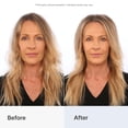 thumbnail image 5 of BOROPLUS Crema Hidratante Ligera con Vitamina E | Hidratante ligero para rostro, manos y cuerpo | Calma, nutre y suaviza la piel seca | Proporciona hidratación las 24 horas | 3,38 onzas líquidas (100, 5 of 5