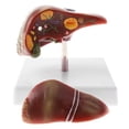 thumbnail image 3 of Modelo Patológico de Hígado Herramienta de Enseñanza de Escuela Sunnimix Estatua de estructura de hígado humano, 3 of 8
