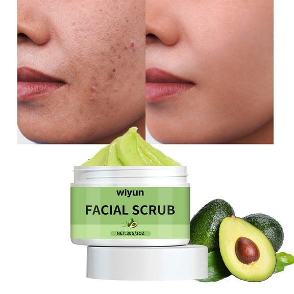 Gzwccvsn Facial Scrub Scrub Cream For Body Exfoliating Face Scrub Cleansing Pores And Moisturizing Dead Skin Chicken Skin Removing Scrub Cream, Moisturizers Skincare Products