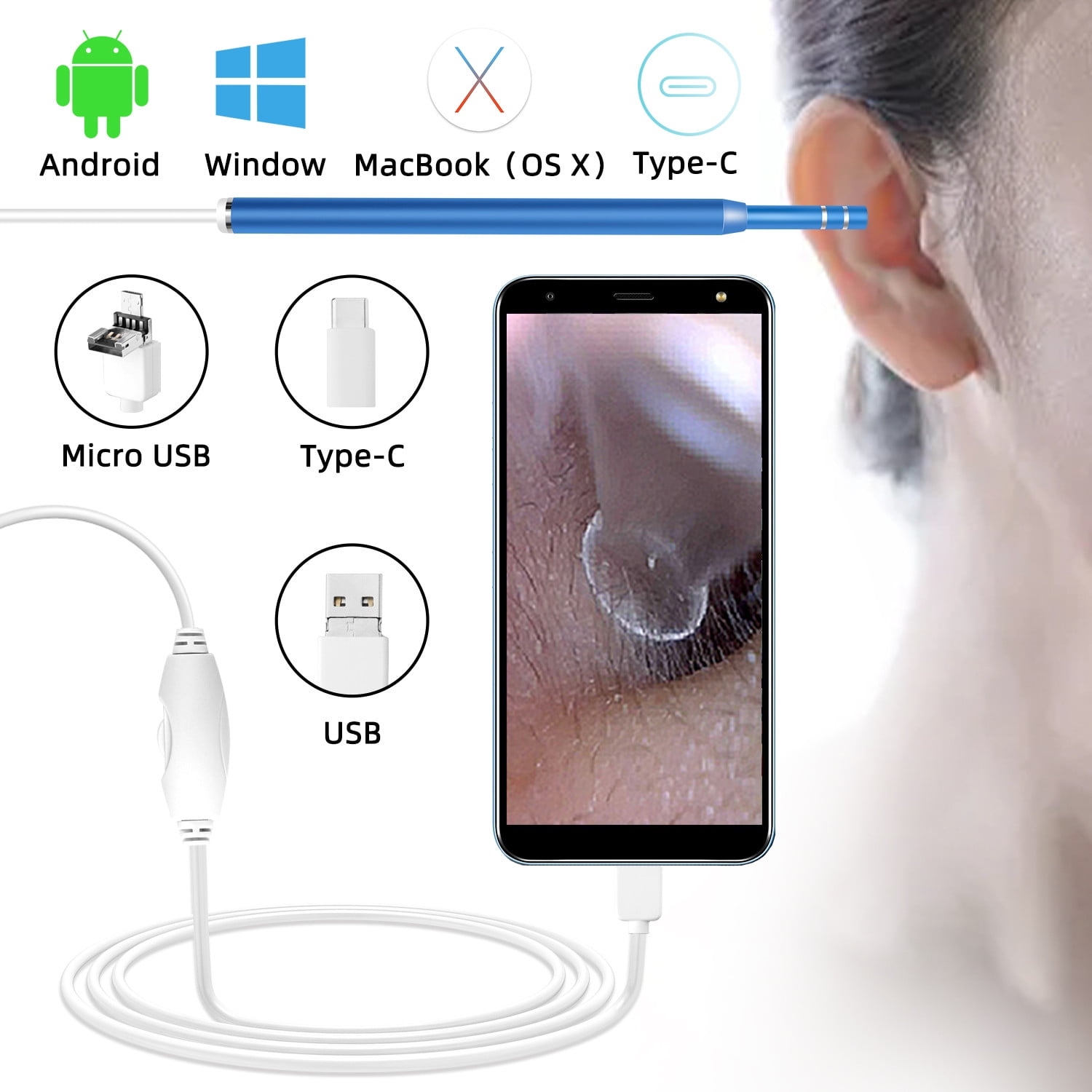 Compatible with Android iOS Smartphone and Tablet LOFTer Upgraded 3.9mm 1080P FHD Ear Camera Set Super Light Ear Wax Remover Tool with Temperature Control Chip White Wireless Digital Otoscope