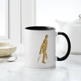 thumbnail image 4 of CafePress - Using Crutches Mug - 11 oz Ceramic Mug - Novelty Coffee Tea Cup, 4 of 4