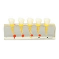 thumbnail image 2 of Modelo de diente de caries BuyWeekMX Modelo de dientes de enseñanza Compacto y liviano, 2 of 9